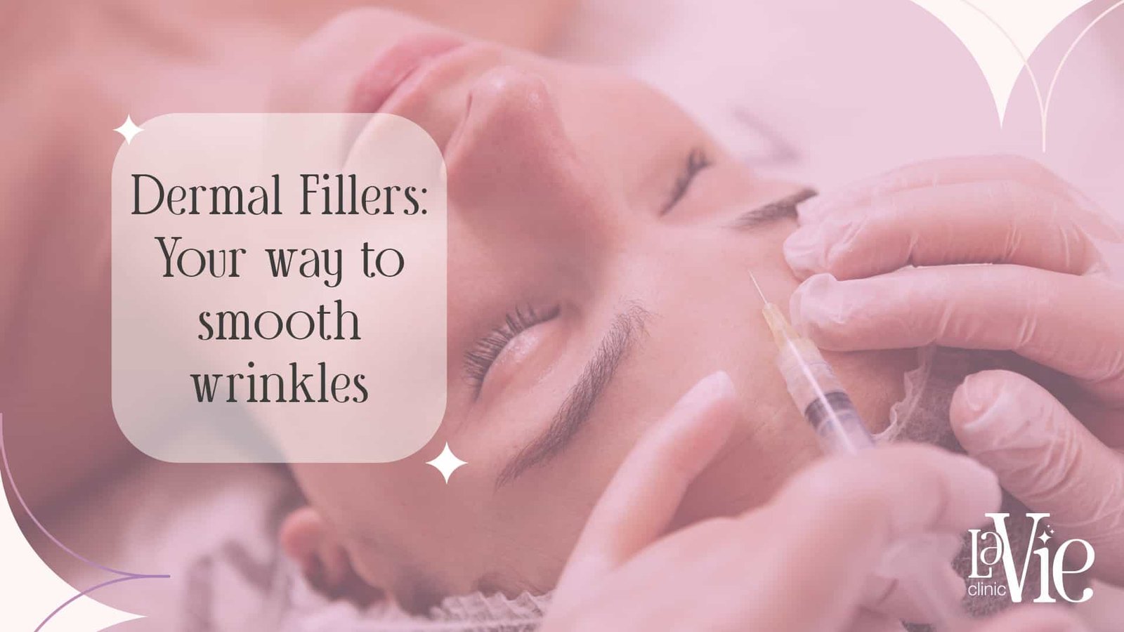 Dermal Fillers Rochester Hills: Why choose it over other options?