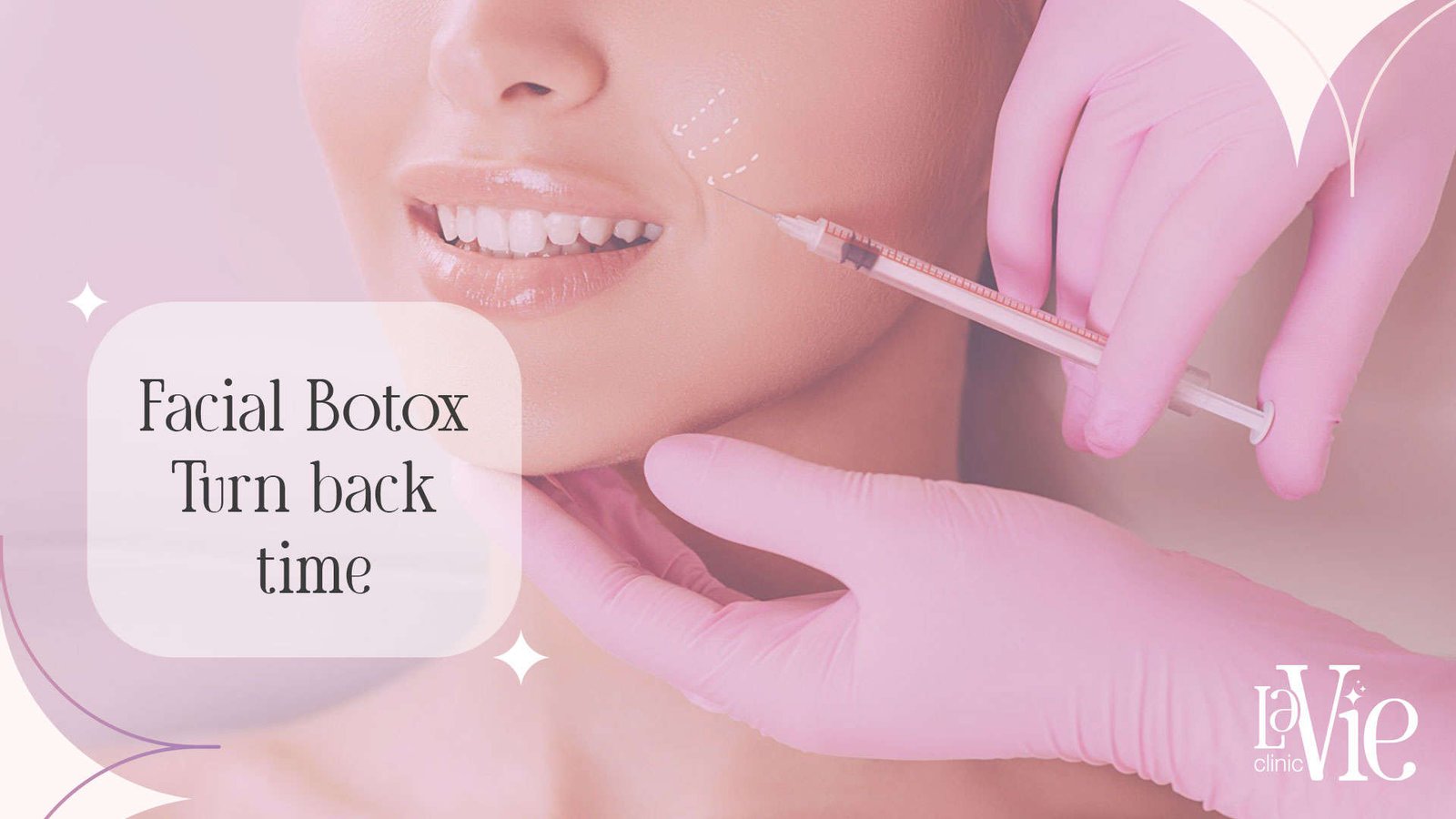 Facial Botox Pontiac: Unveiling the Secret to Ageless Beauty.