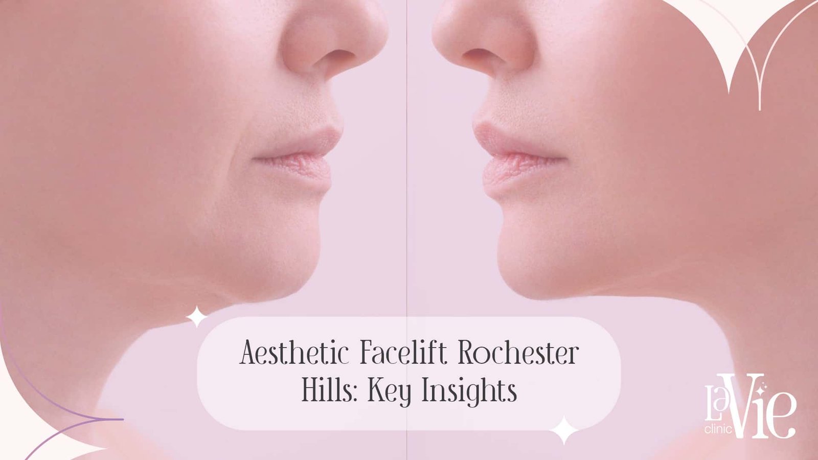 The Ultimate Guide For No Surgery Aesthetic Facelift Rochester Hills