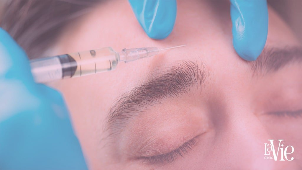specialist injects Dermal Fillers solution into the face to to reduce the signs of aging, minimize skin depressions and scars,La Vie Clinic Rochester Hills