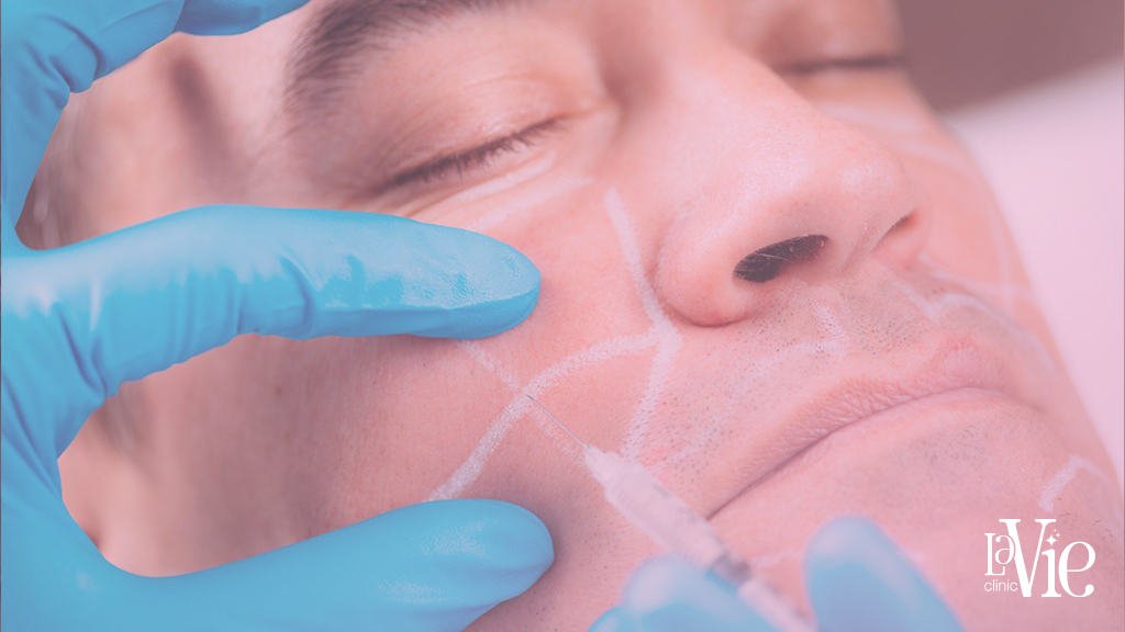 botox after care Rochester mi