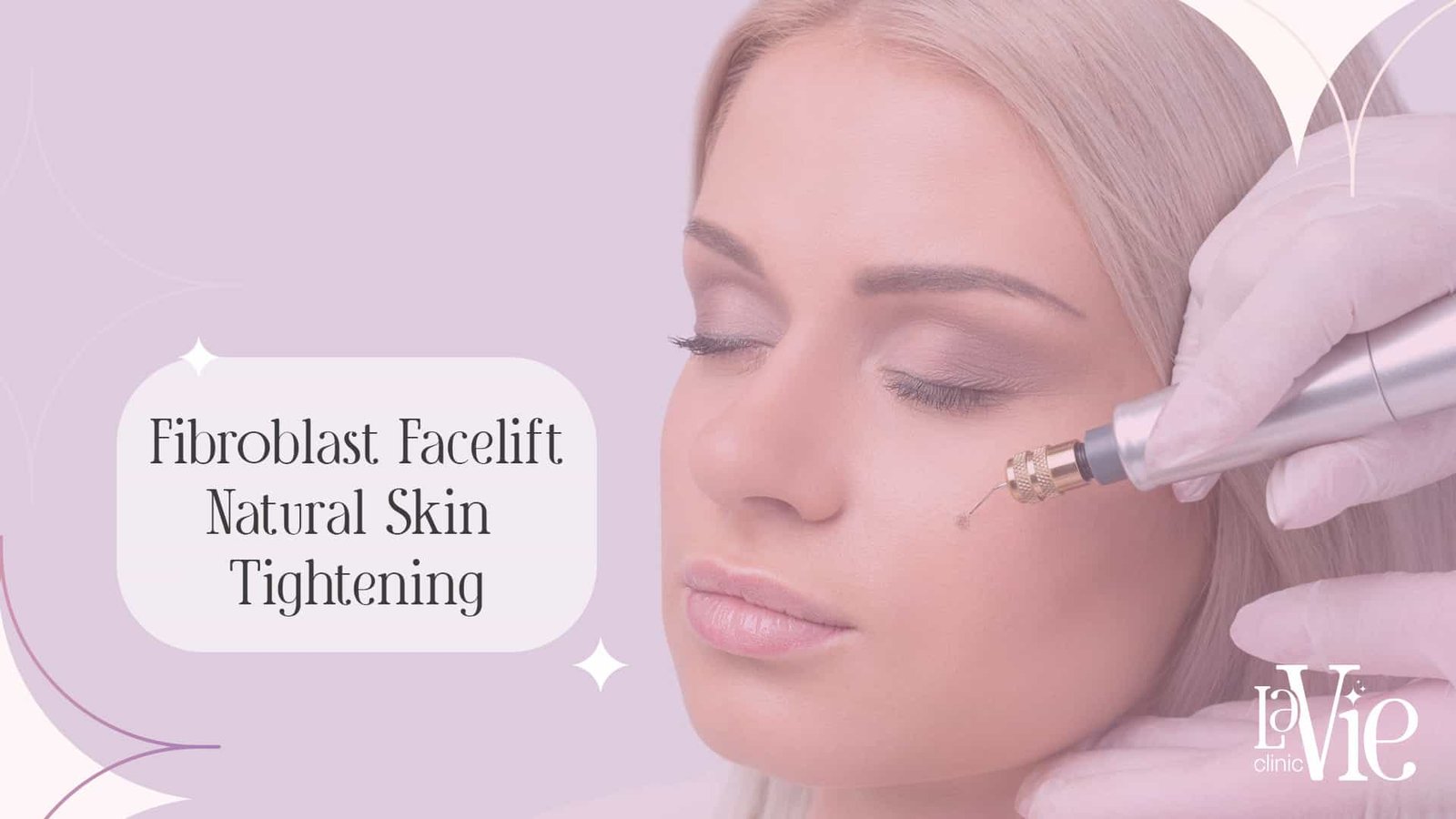 specialist injects Non-Surgical Facelift solution into the cheeks to improve skin texture, offer mild-to-moderate skin tightening effects, result in some degree of skin facial contour change,La Vie Clinic Rochester Hills.
