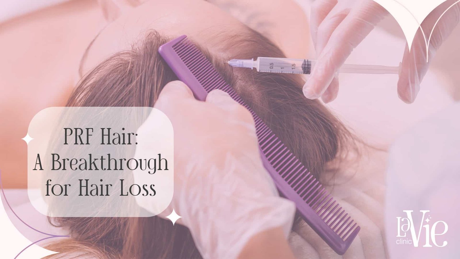 PRF Hair Auburn Hills: Revive Thinning Hair Naturally  