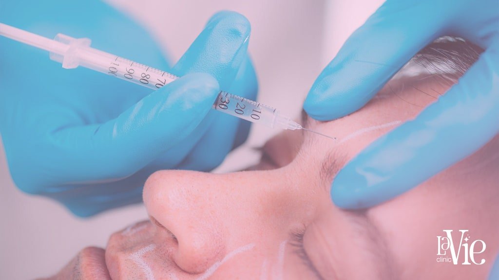 dermal fillers before and after