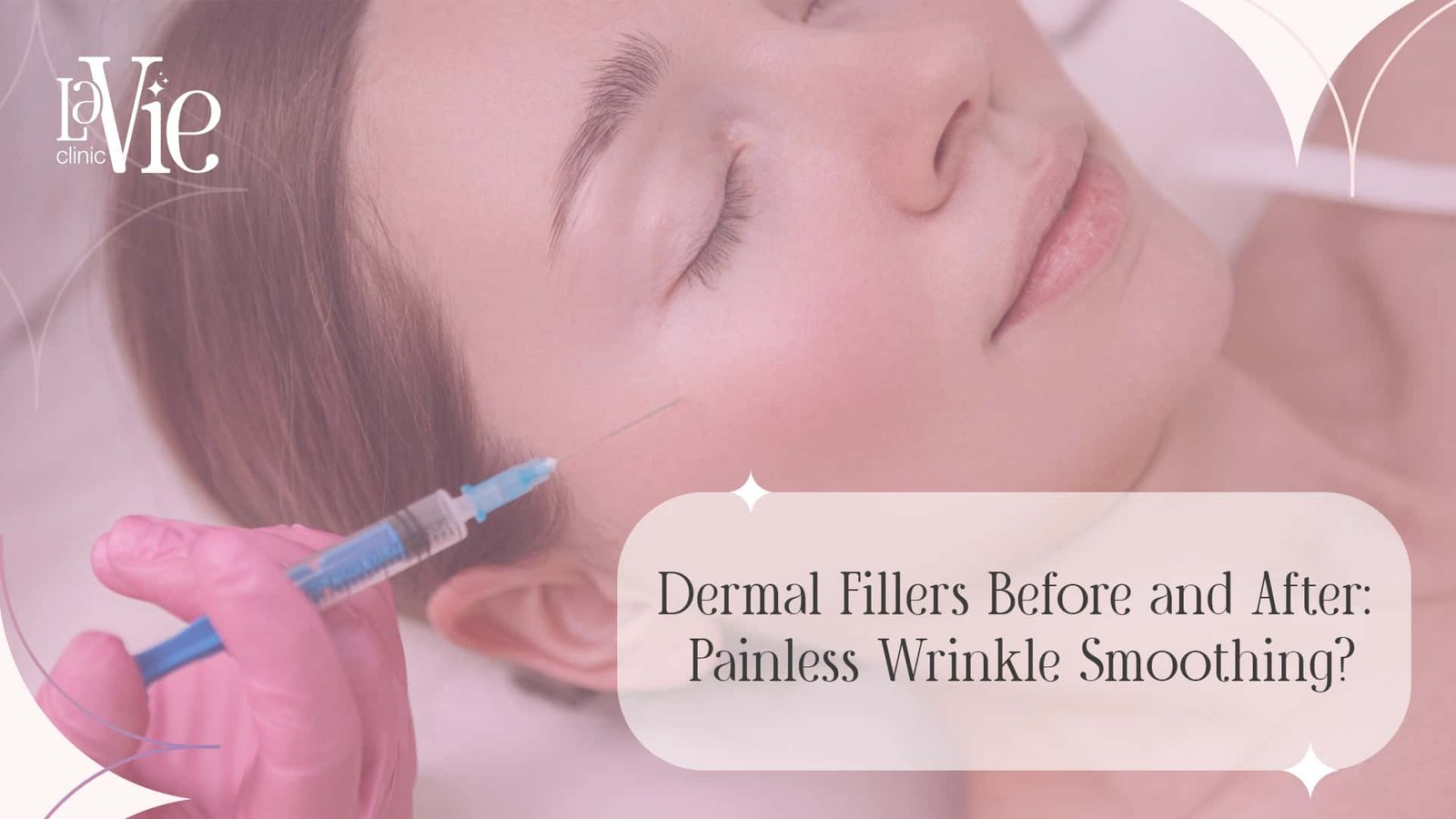 Dermal Fillers Before and After: Painless Wrinkle Smoothing?