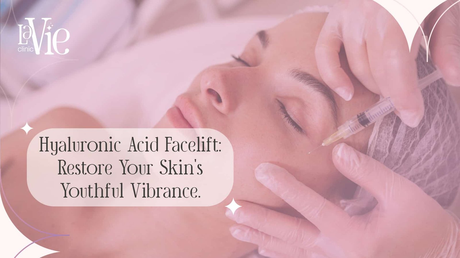 Hyaluronic Acid Facelift: Restore Your Skin’s Youthful Vibrance