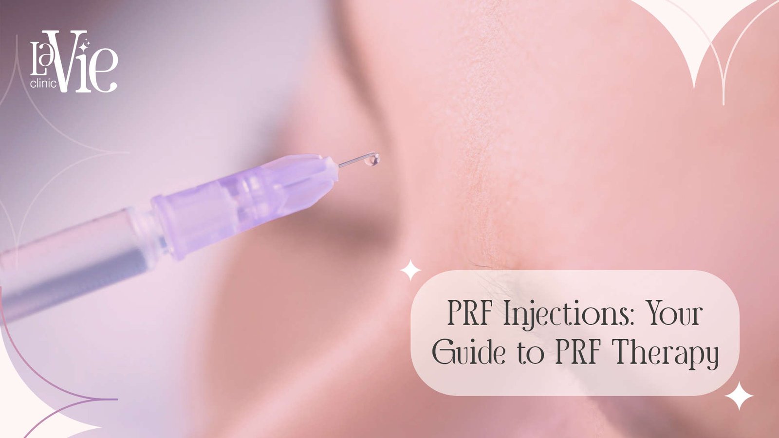 PRF Injections: Your Guide to PRF Therapy