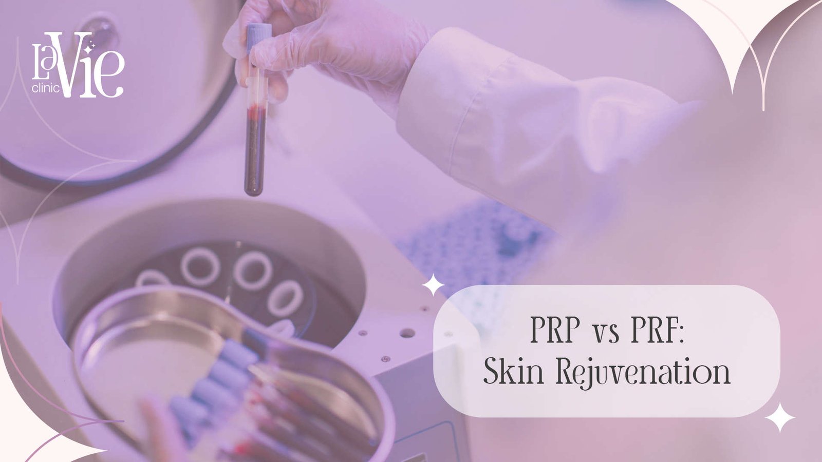 PRP vs PRF Treatment : Skin Rejuvenation
