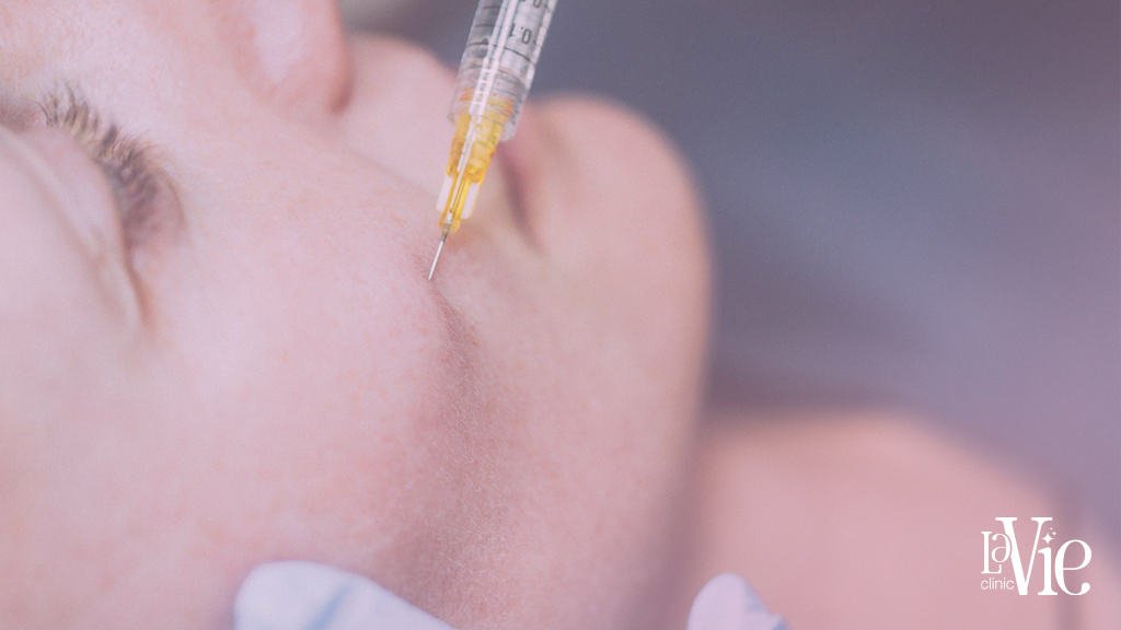 Facial PRP Injections Broomfield hills