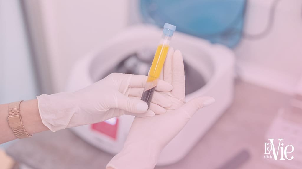 Facial PRP Injections
