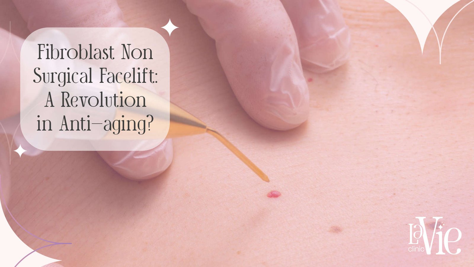 Fibroblast Non Surgical Facelift