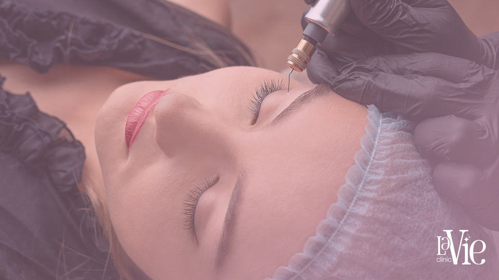 full face fibroblast before and after results