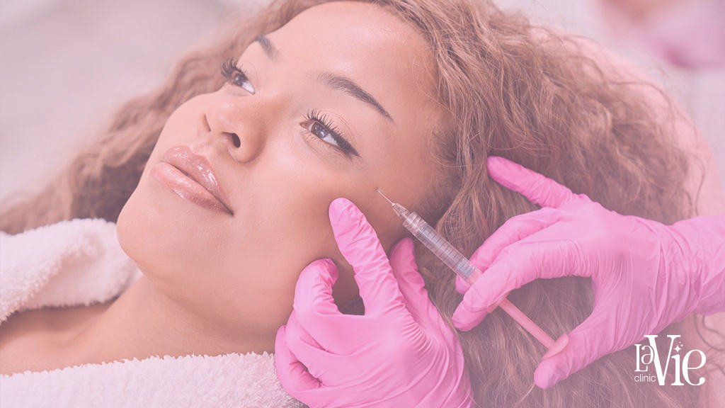 Masseter botox Rochester Hills Results - La Vie Aesthetic Clinc