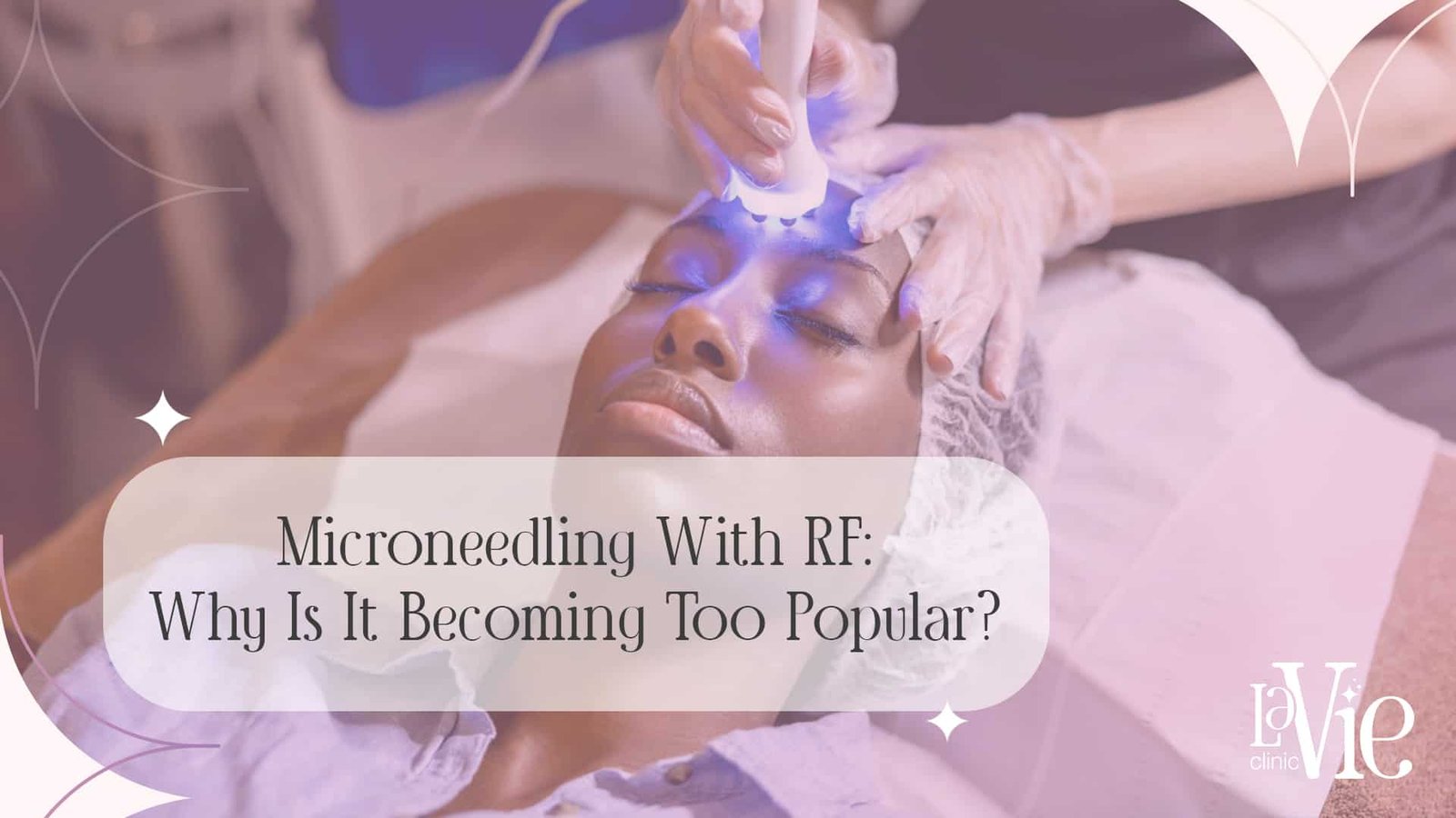 Microneedling With RF: The Full Guide For Youthful Perfect Skin