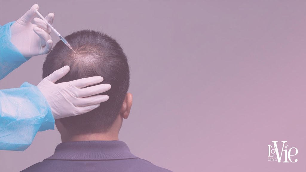 Cost of PRP Injections