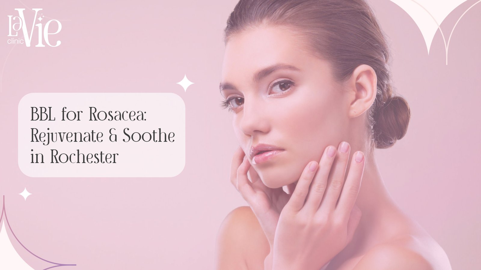 BBL for Rosacea: Rejuvenate & Soothe in Rochester Hills