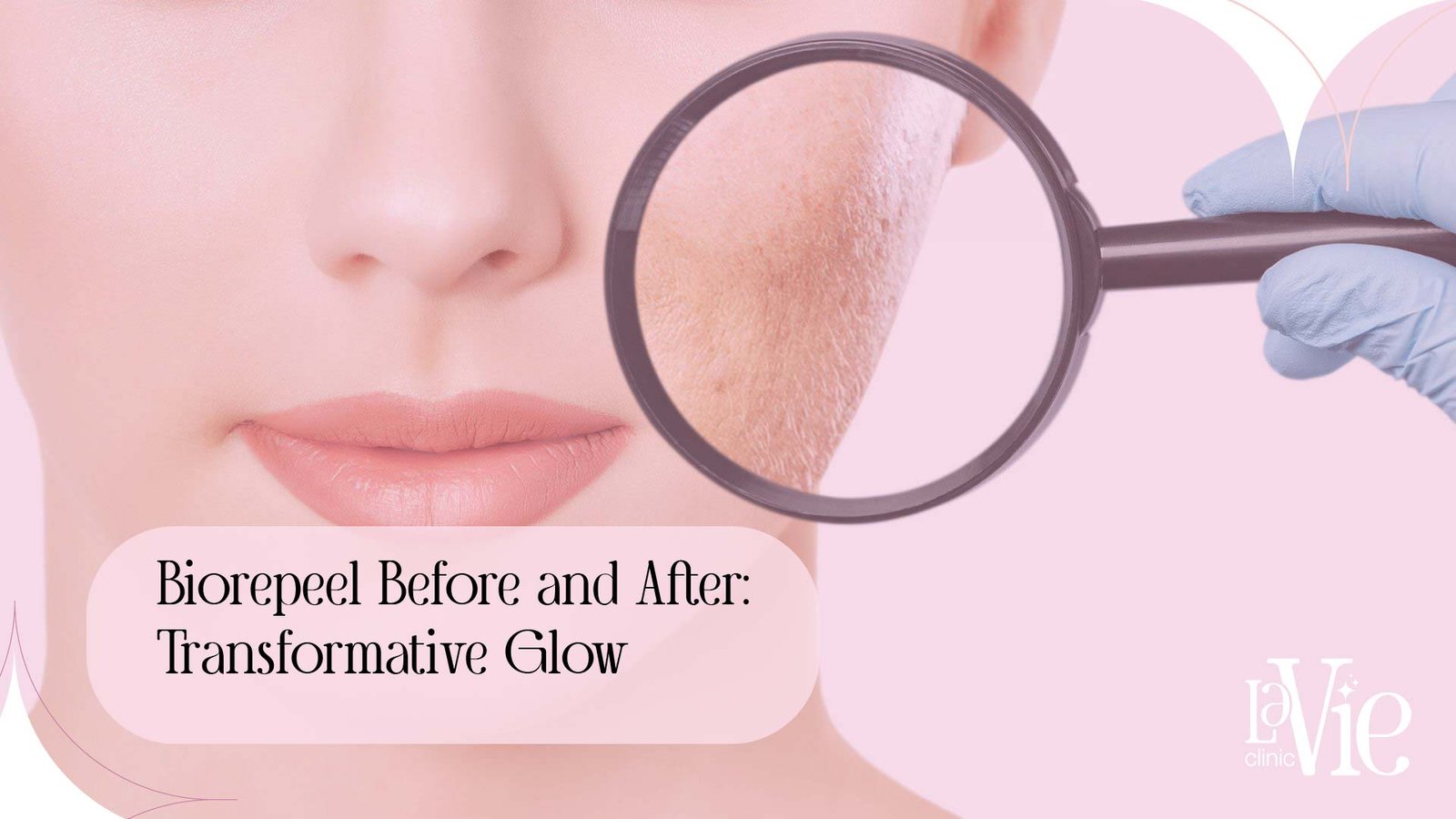 Biorepeel Before and After: Transformative Glow
