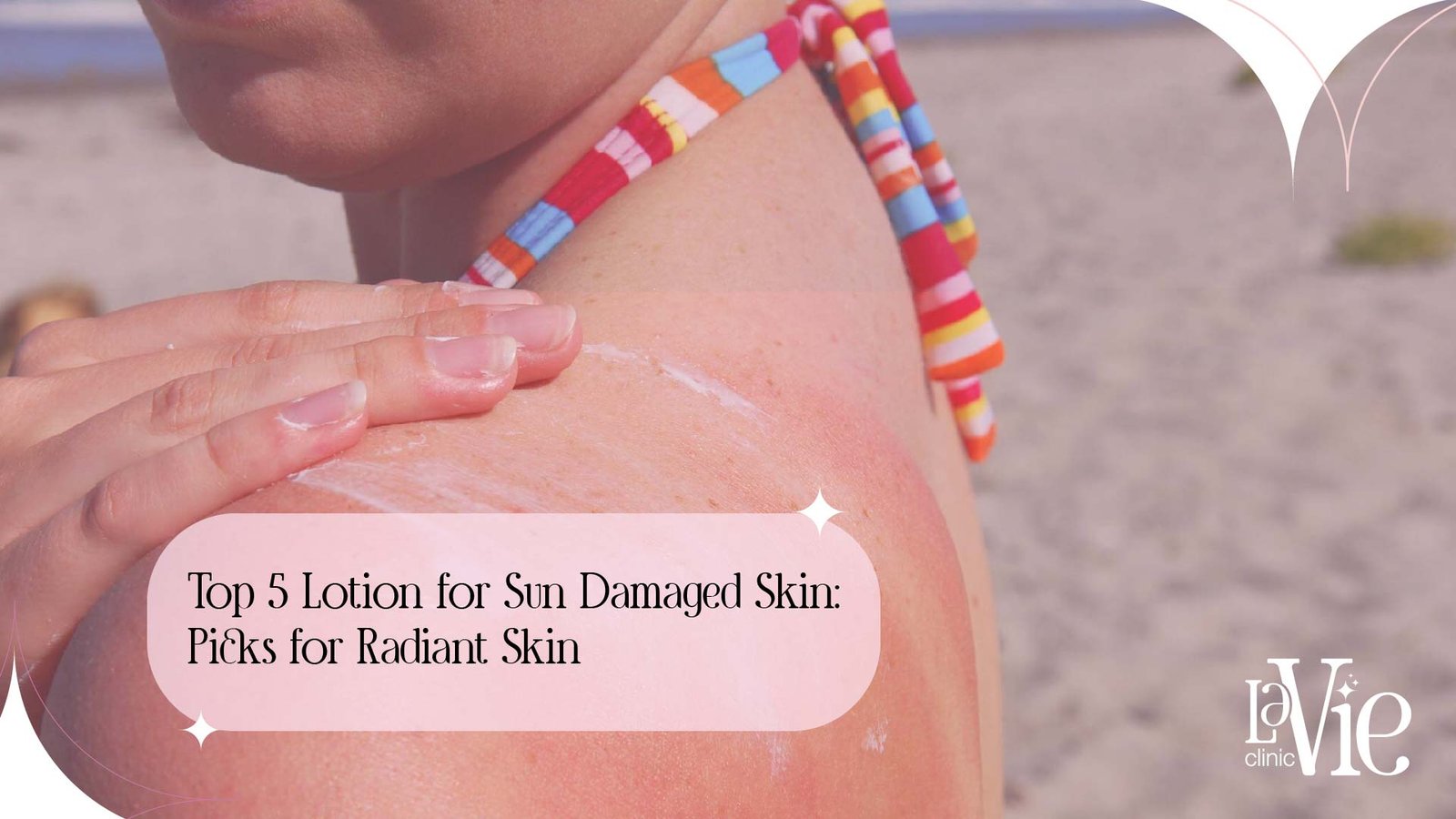best lotion for sun damaged skin