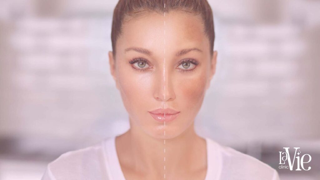 serum for uneven skin tone