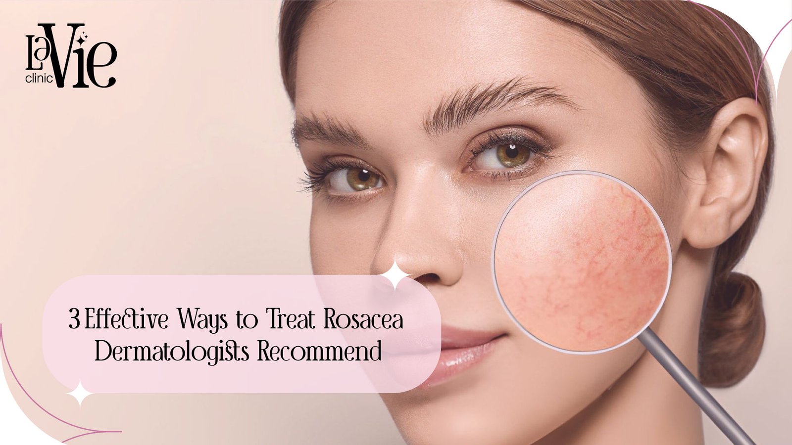 3 Effective Ways of BBL Laser for Rosacea in 2026 | Dermatologists Recommend