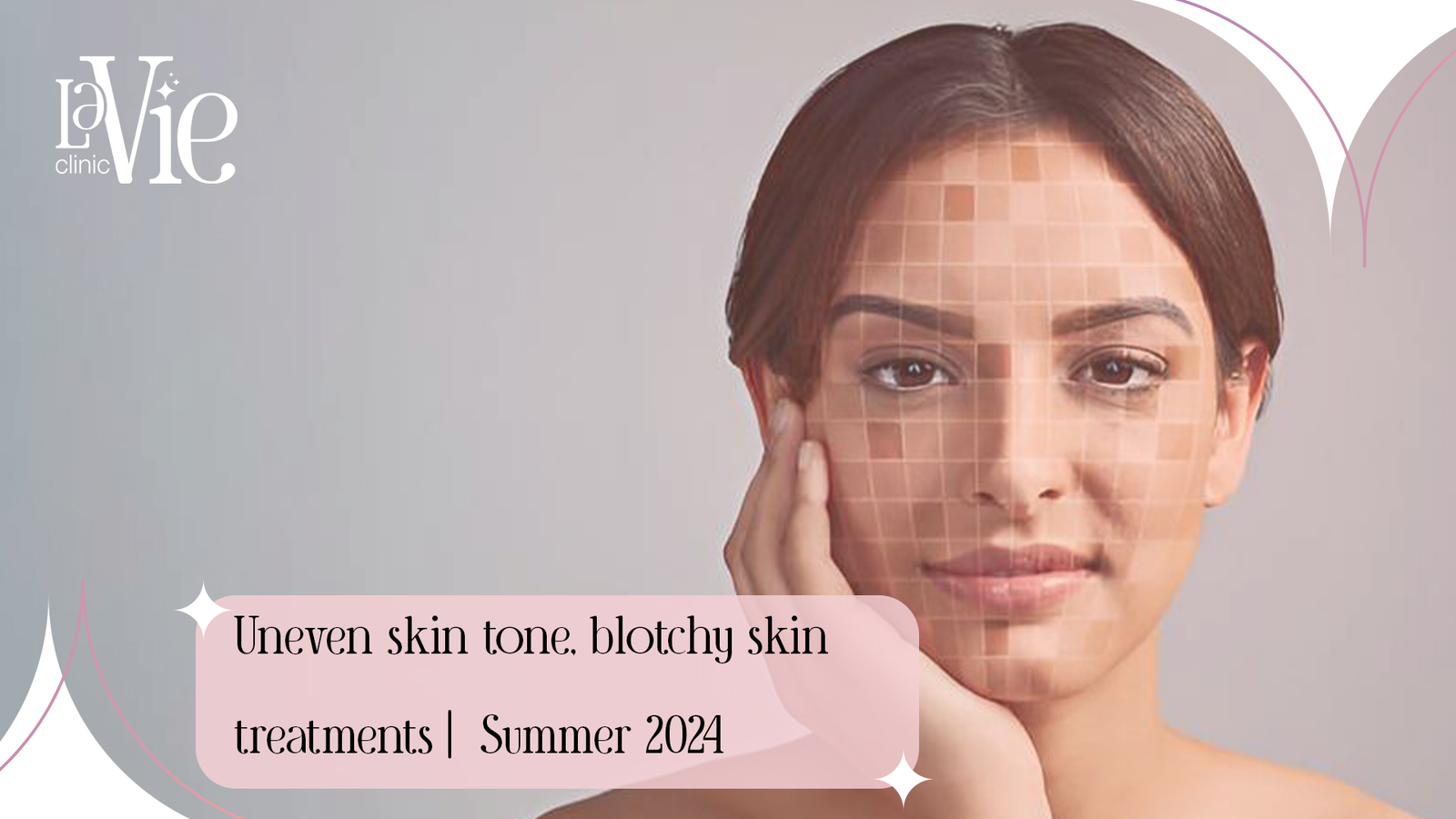Uneven Skin Tone, Blotchy Skin Treatments | Summer 2024