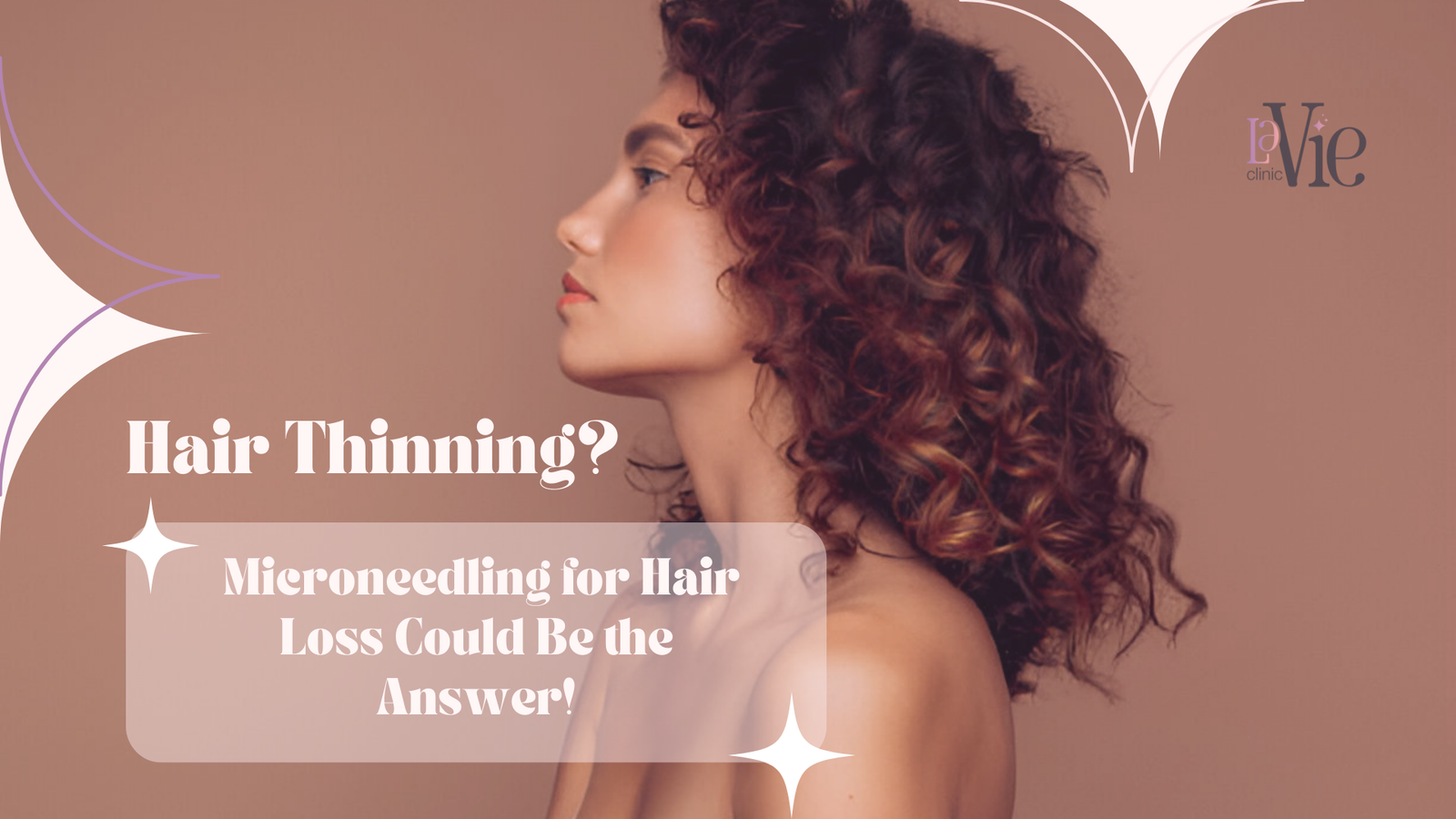 microneedling for hair loss