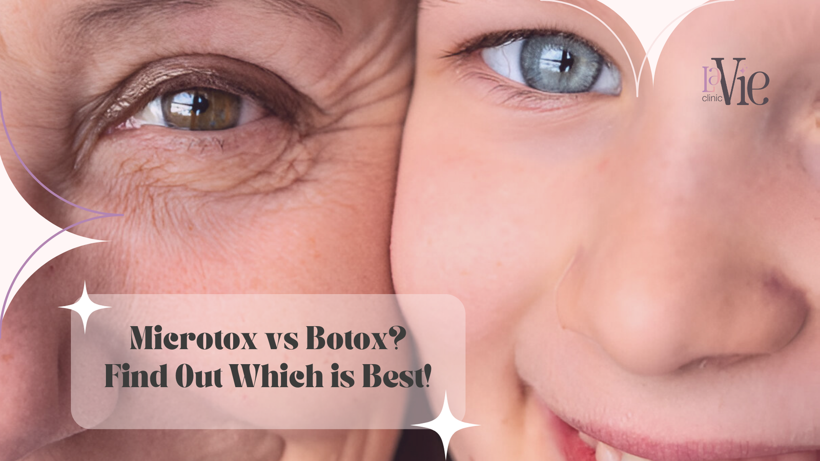 Microtox vs Botox