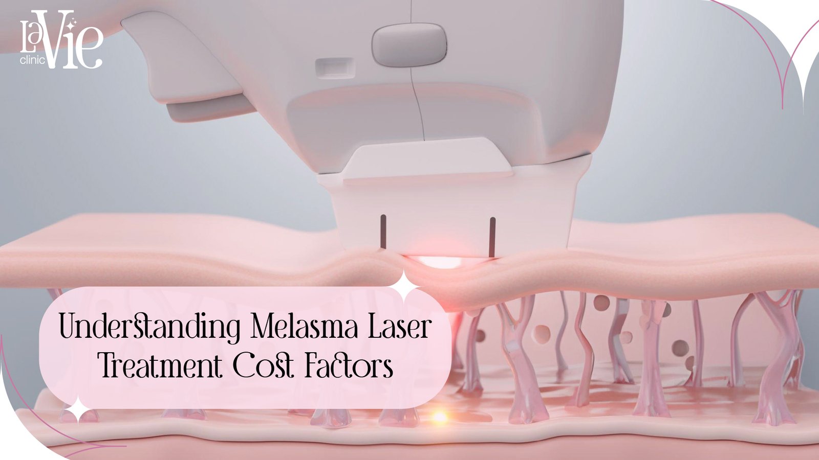 Melasma-Laser-Treatment-Price-Factors