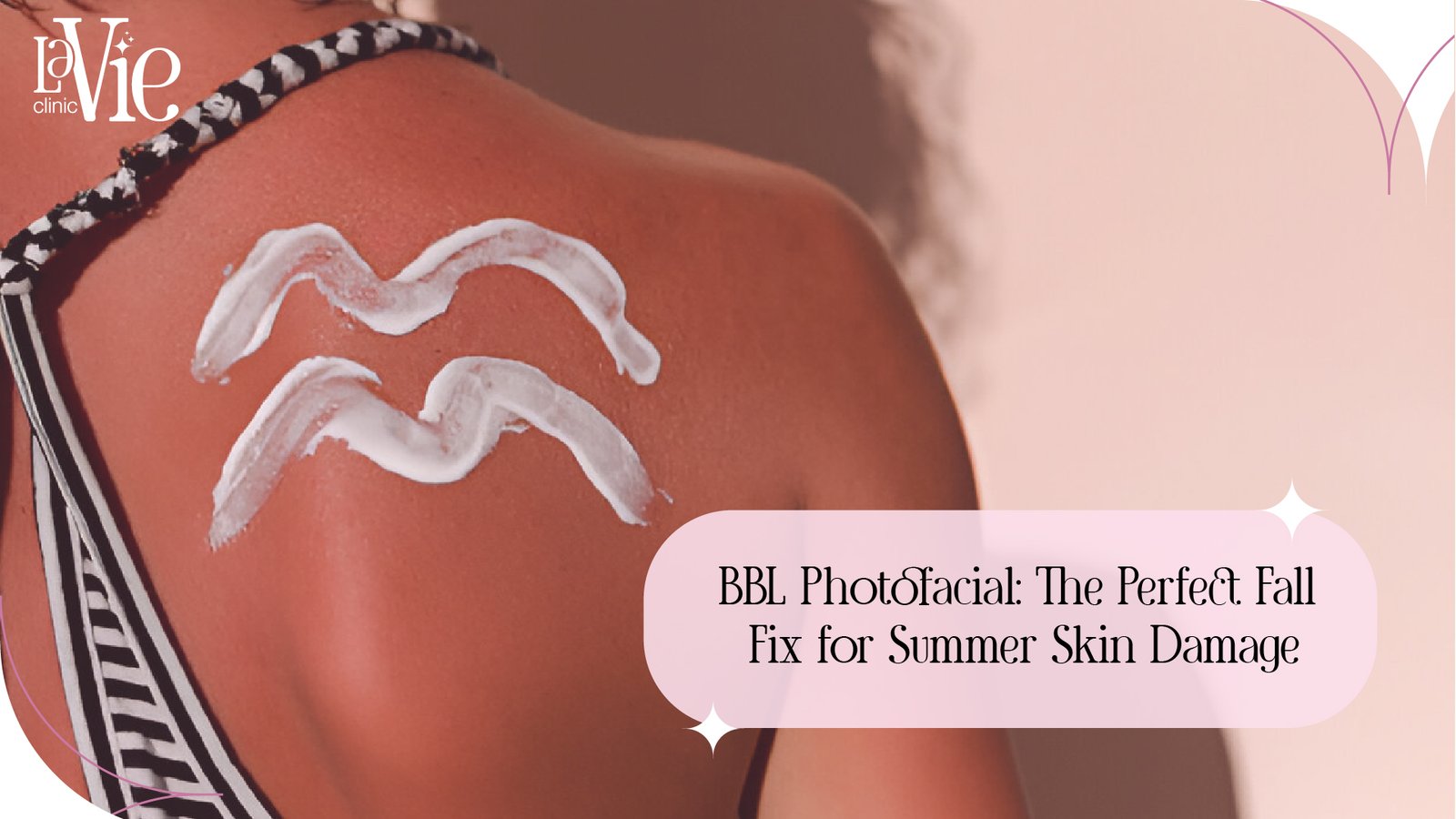 BBL Photofacial Treatment