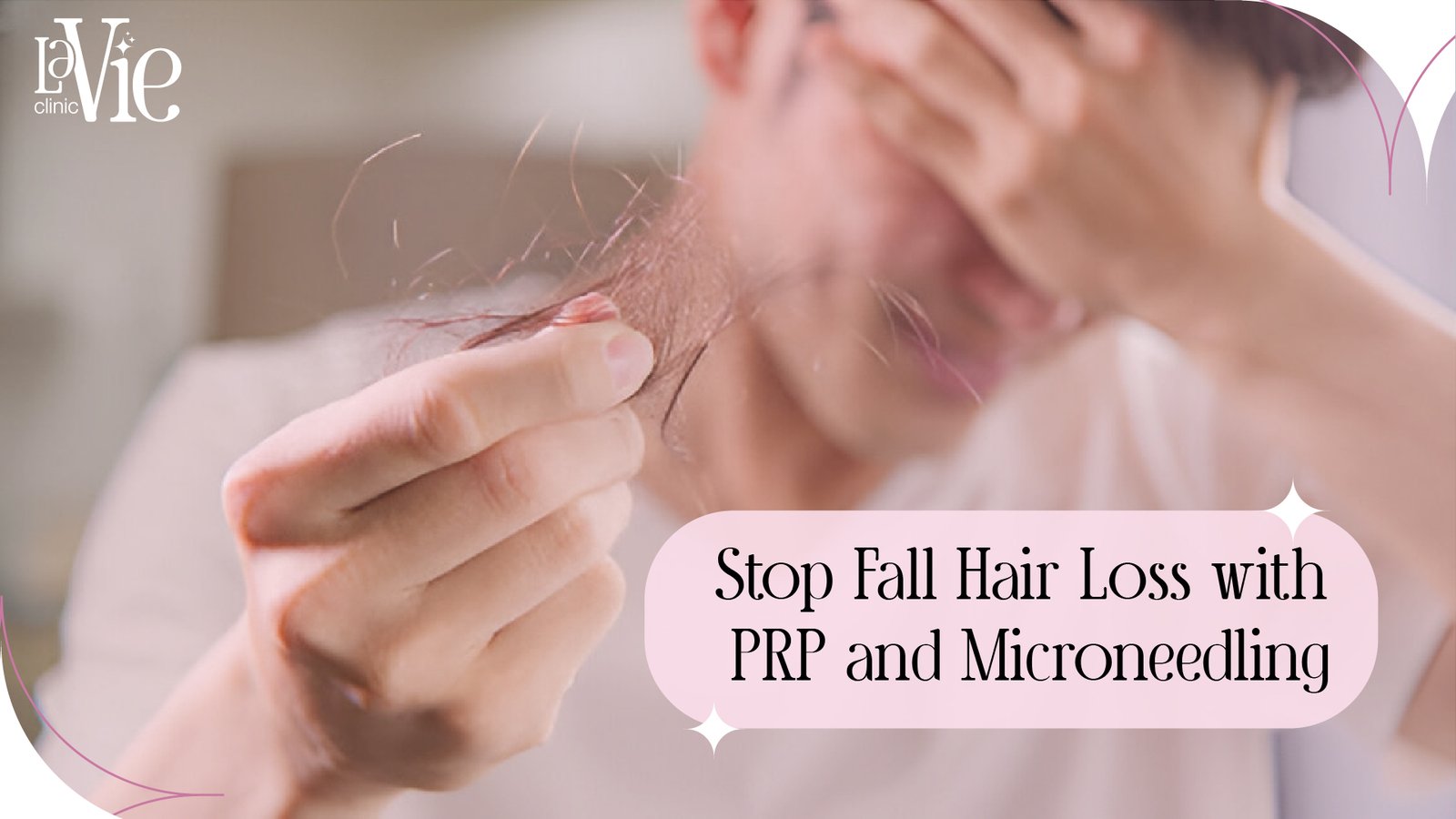 Stop Fall Hair Loss with PRP and Microneedling