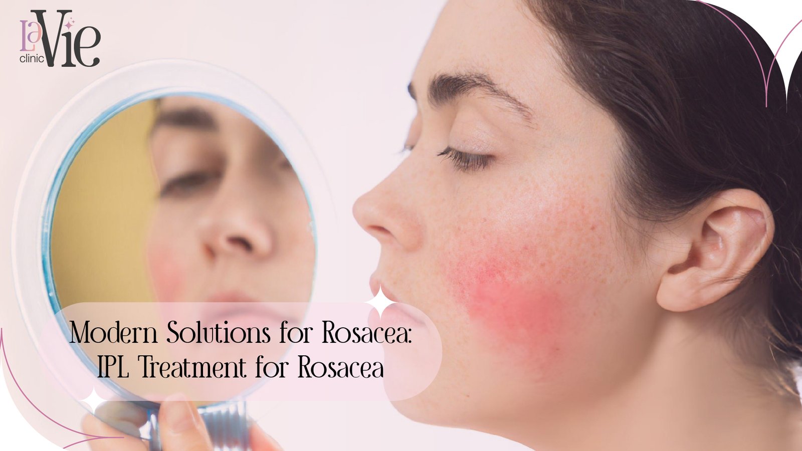 Modern-Solutions-for-Rosacea-IPL-Treatment-for-Rosacea