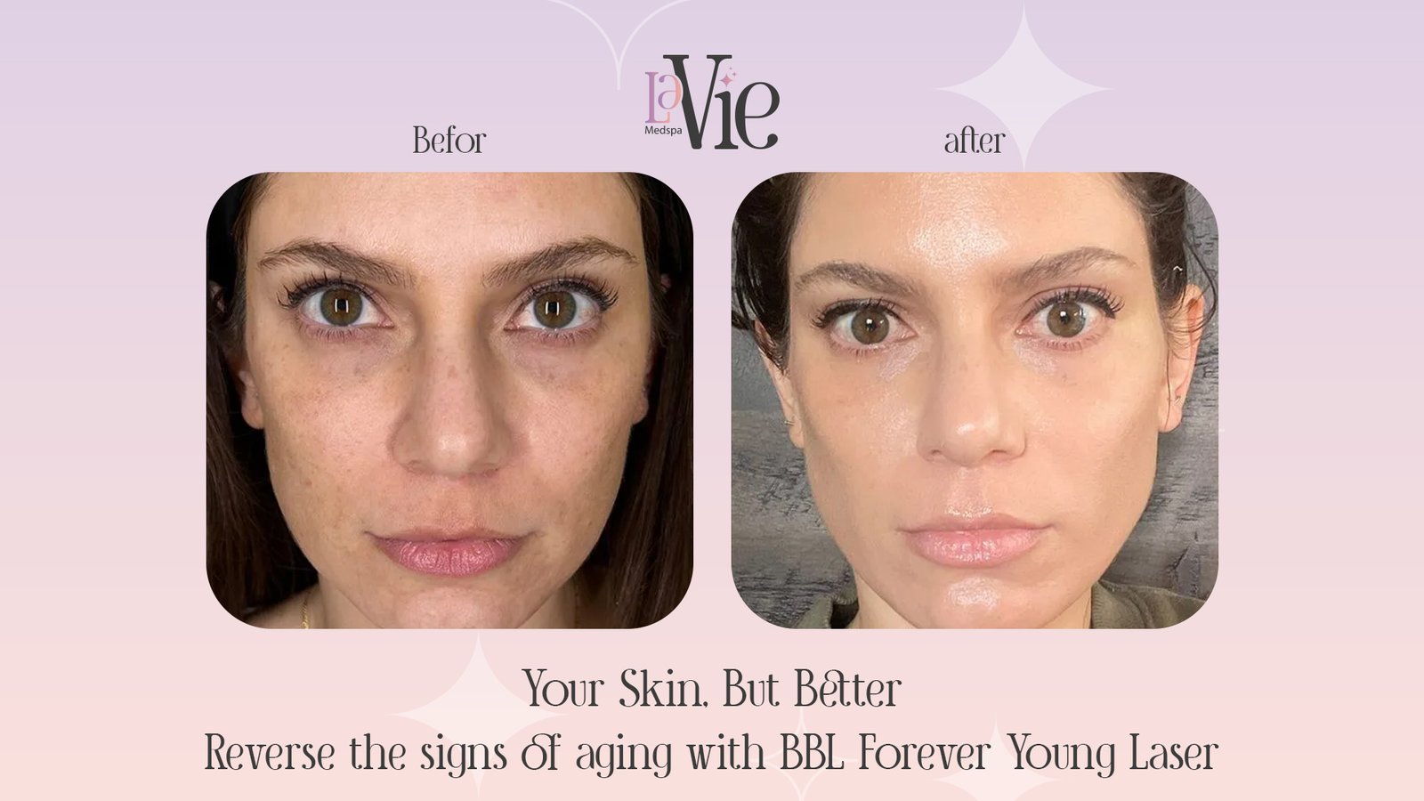 The Ultimate 4 Habits in Troy Mi to Adopt for Skincare Over 50