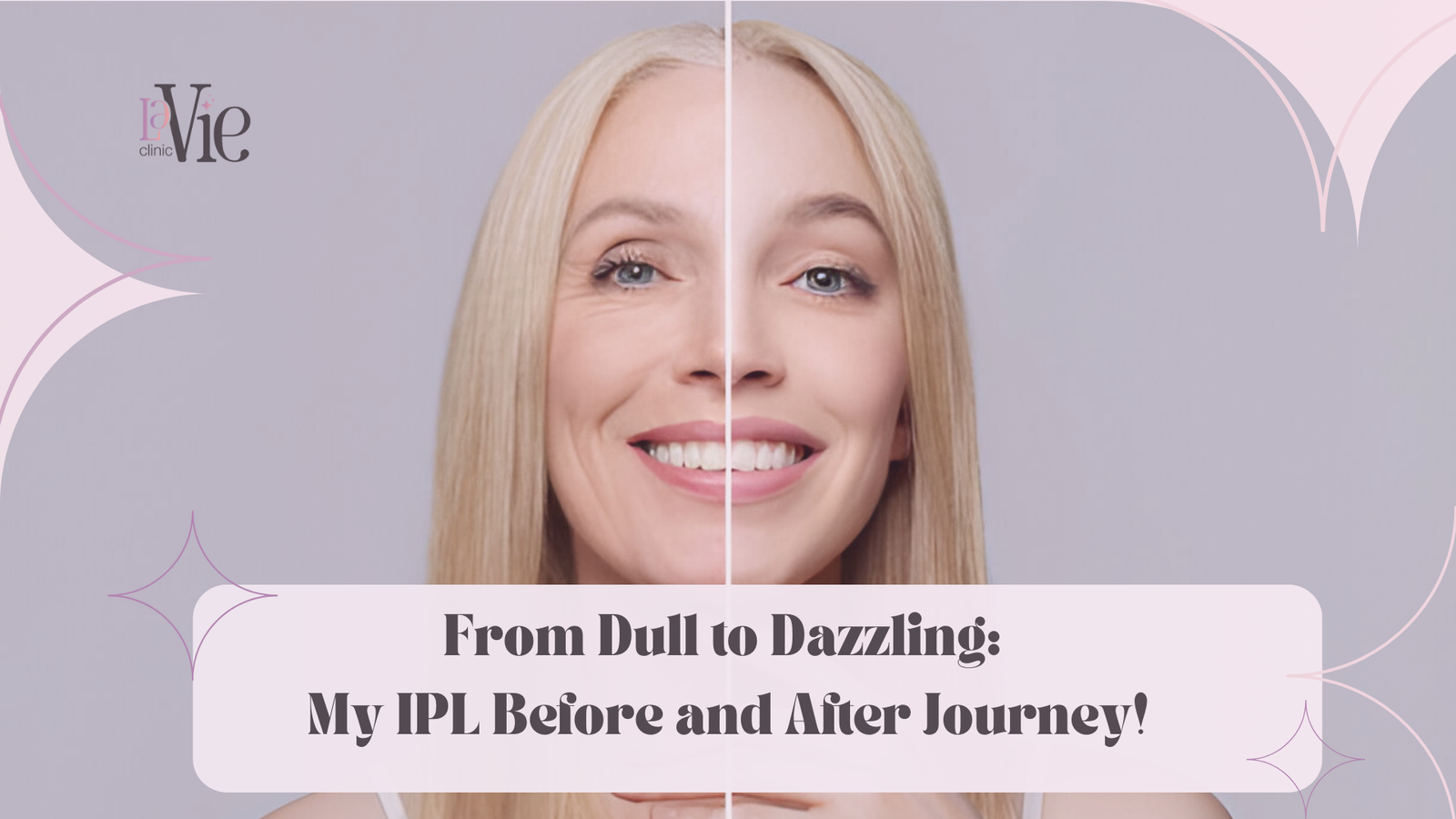 From Dull to Dazzling: My IPL Before and After Journey