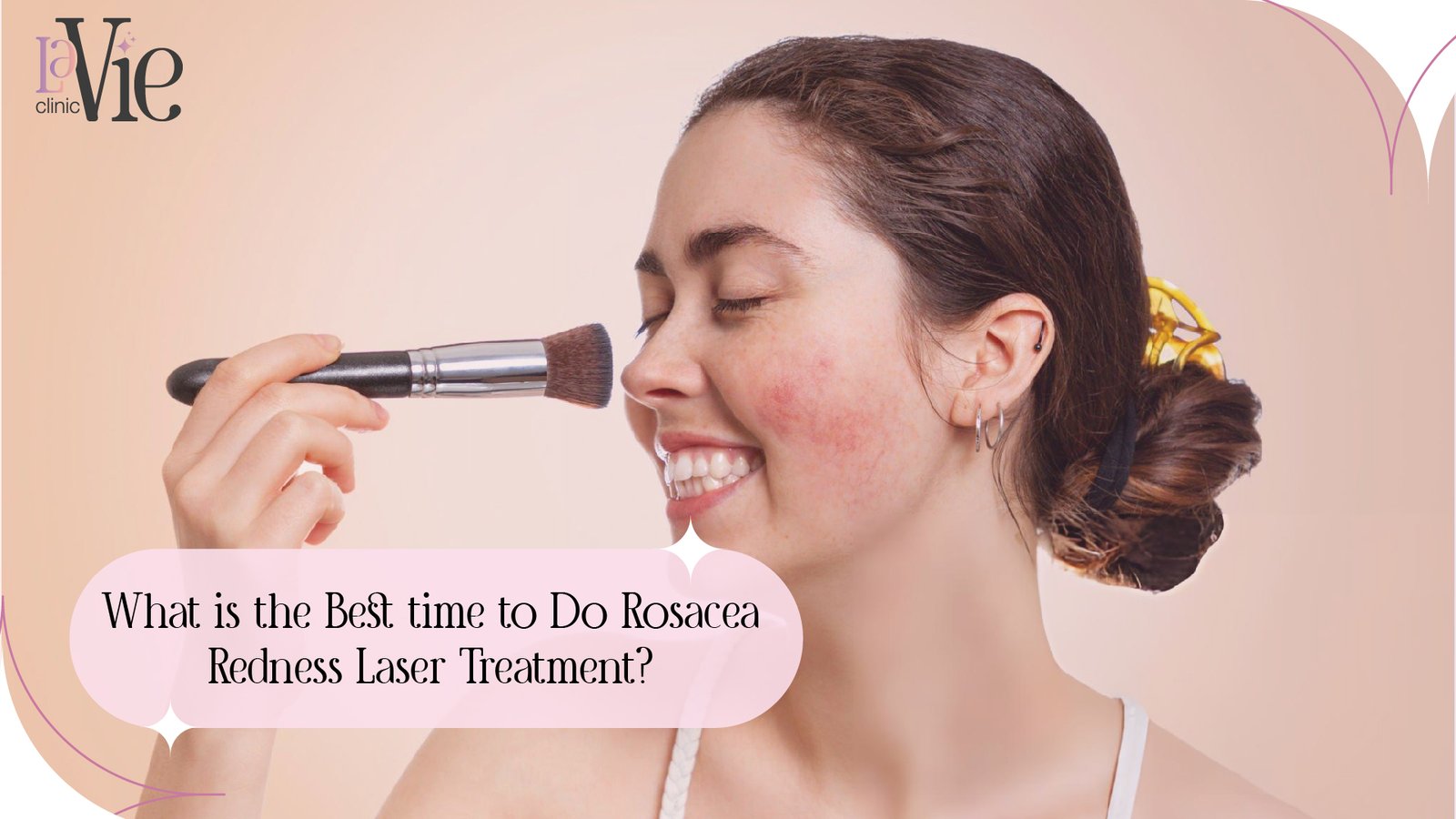 What is the Best Time to Do Rosacea Redness Laser Treatment?
