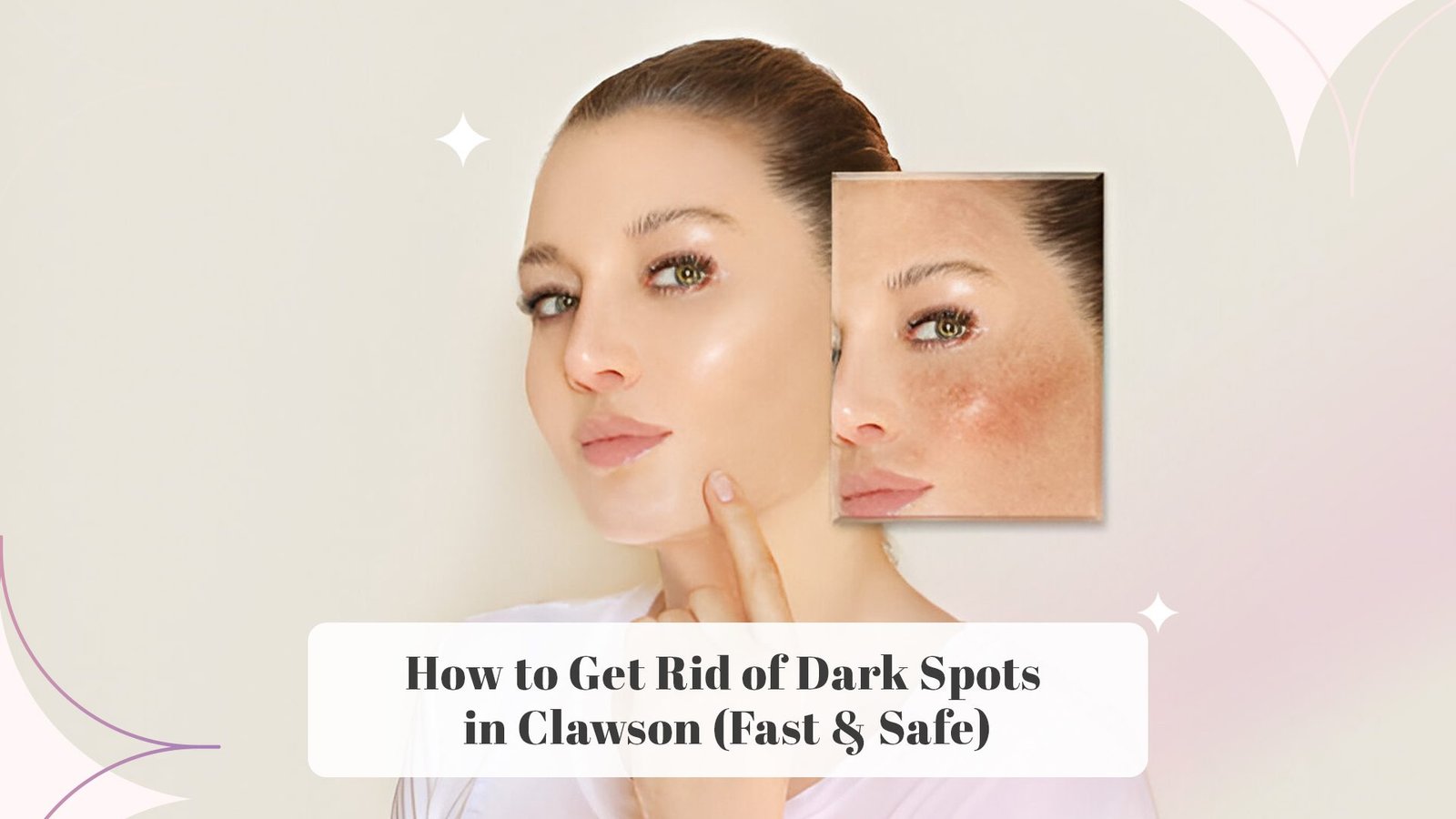 How to Get Rid of Dark Spots in Clawson (Fast & Safe)