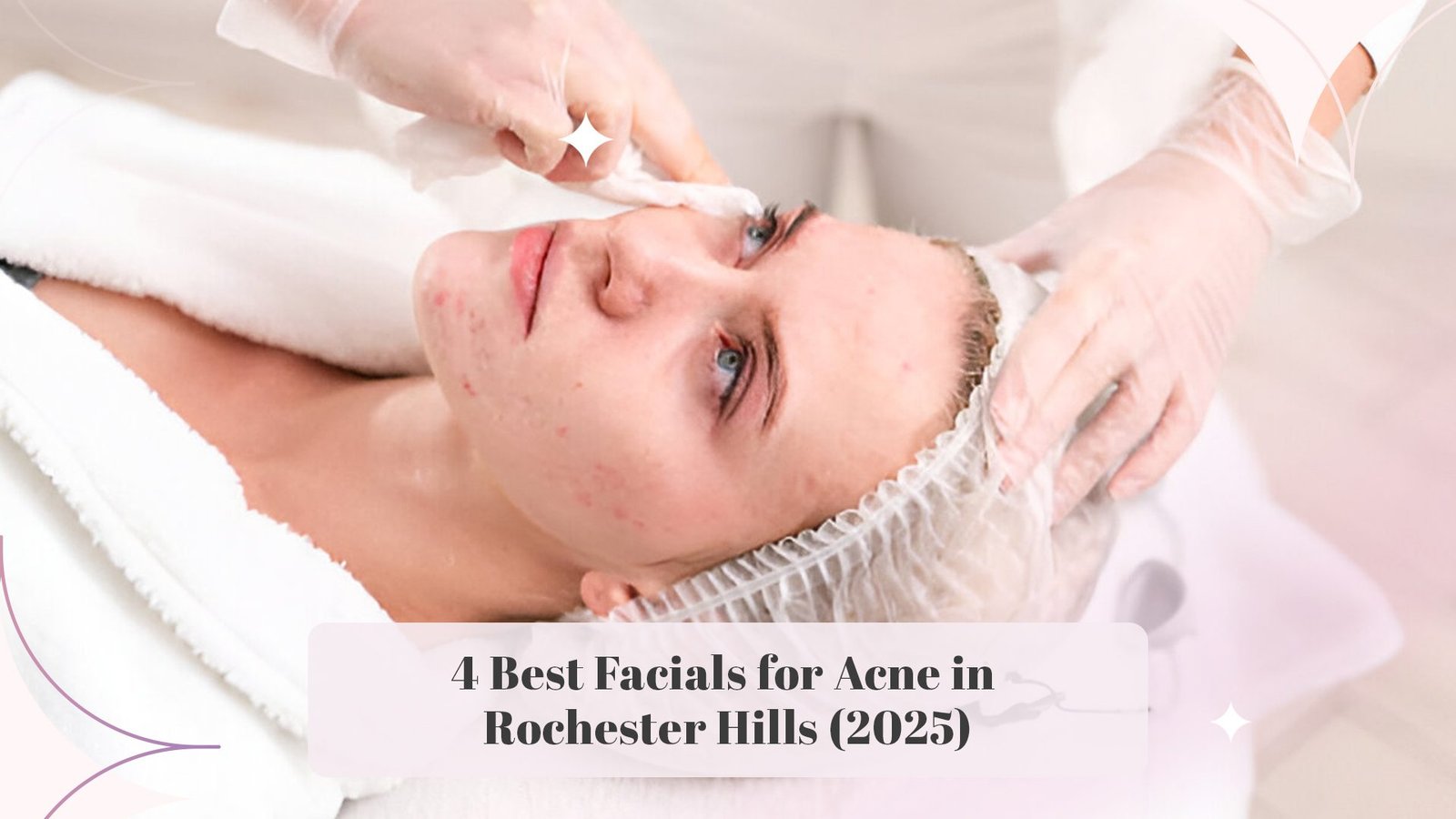 4 Best Facials for Acne in Rochester Hills (2025)