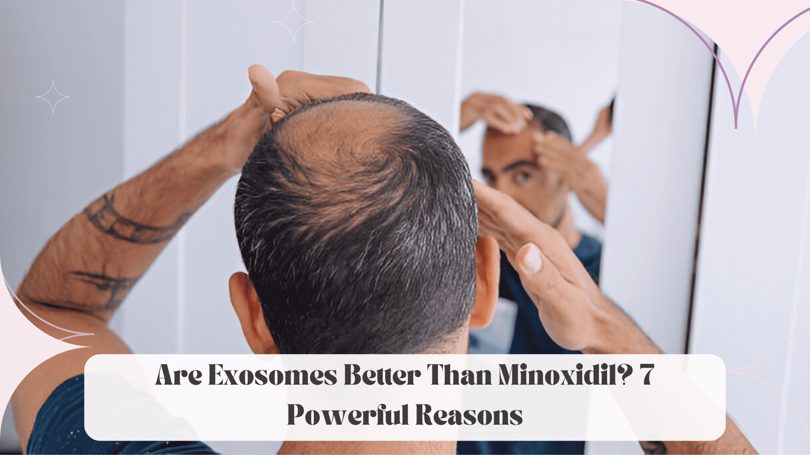 Are Exosomes Better Than Minoxidil? 7 Powerful Reasons