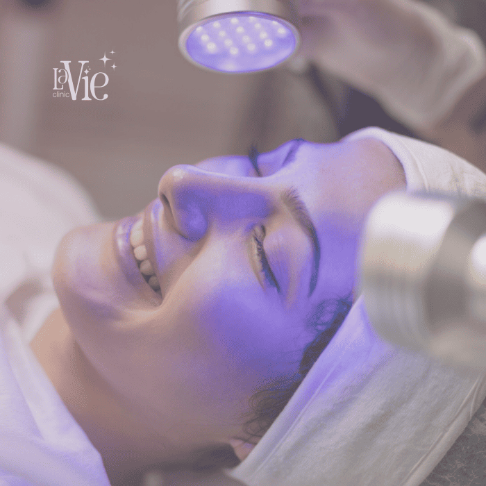 Acne Laser & LED Treatment