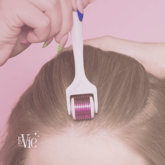 Derma Roller with Biotin for Hair