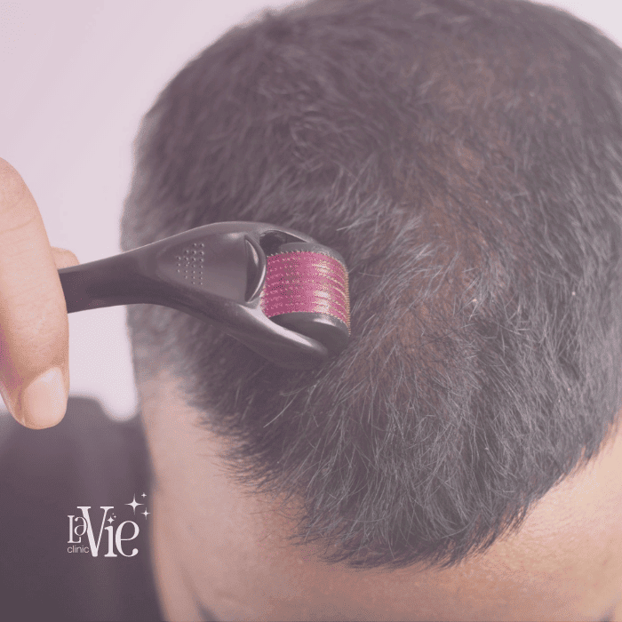 Derma Roller with Biotin for Hair