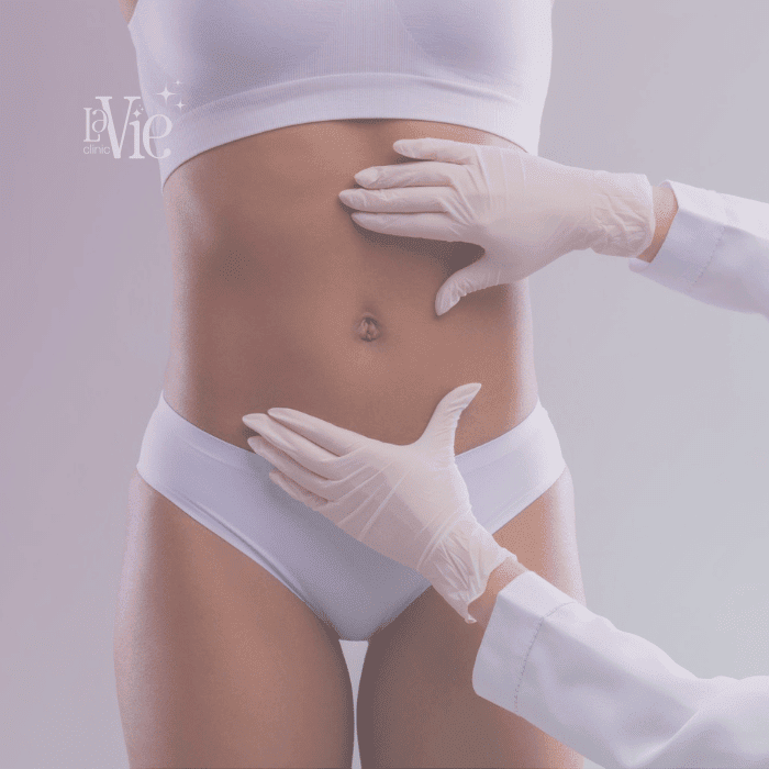 Fibroblast Non-Surgical Body Lift