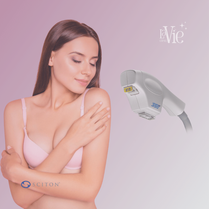 Forever Bare BBL Laser Hair Removal
