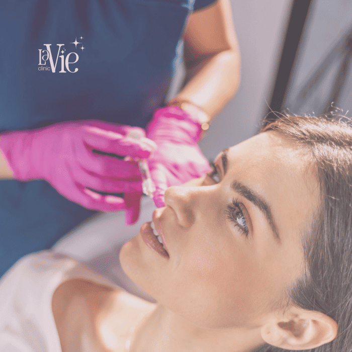 Hyaluronic Acid Facelift
