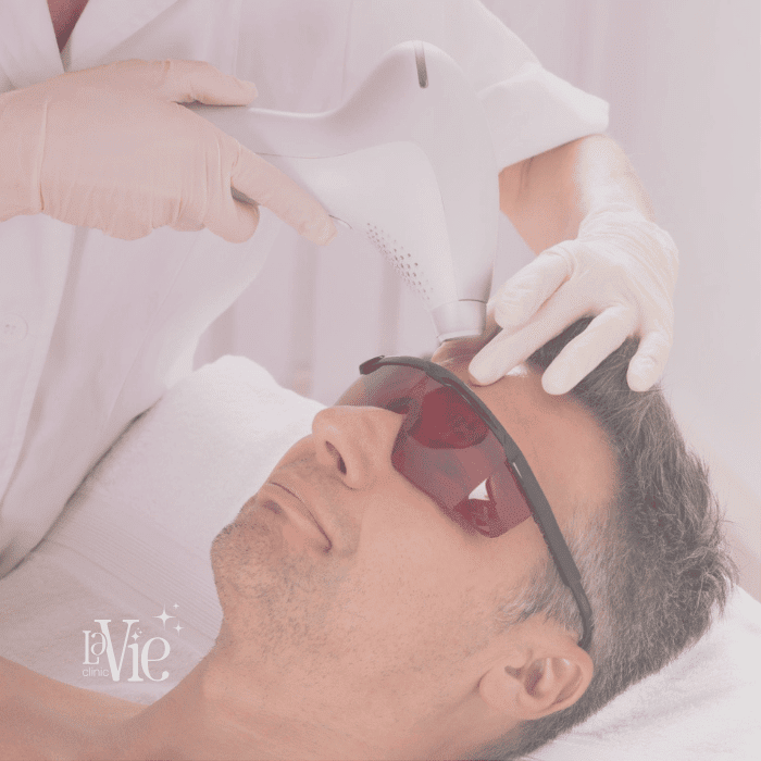 Low Laser Therapy (LLLT)