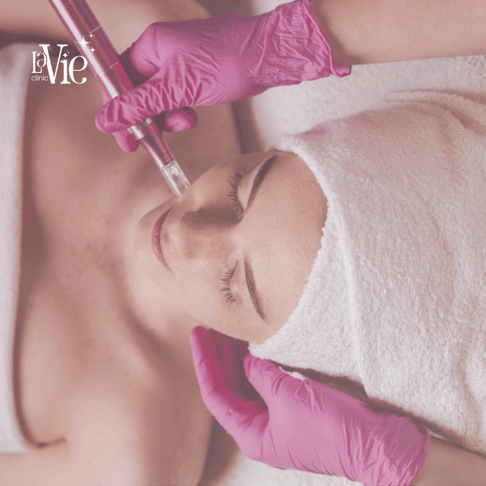 Microneedling