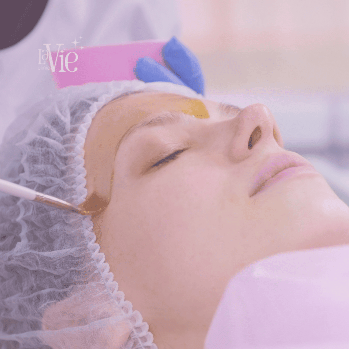 The Perfect™ Derma Peel