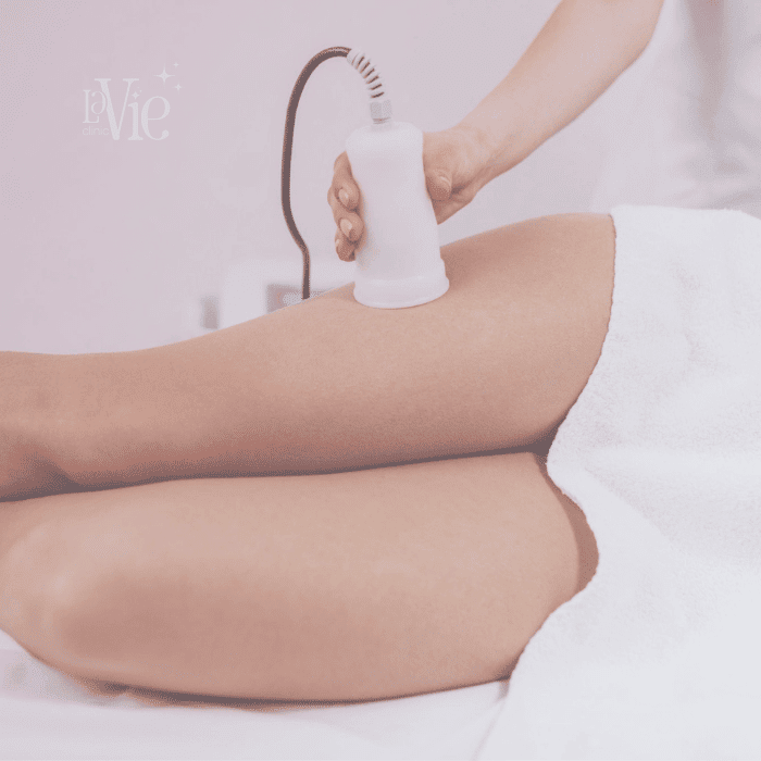 Vacuum therapy & Non-Surgical Butt Lift